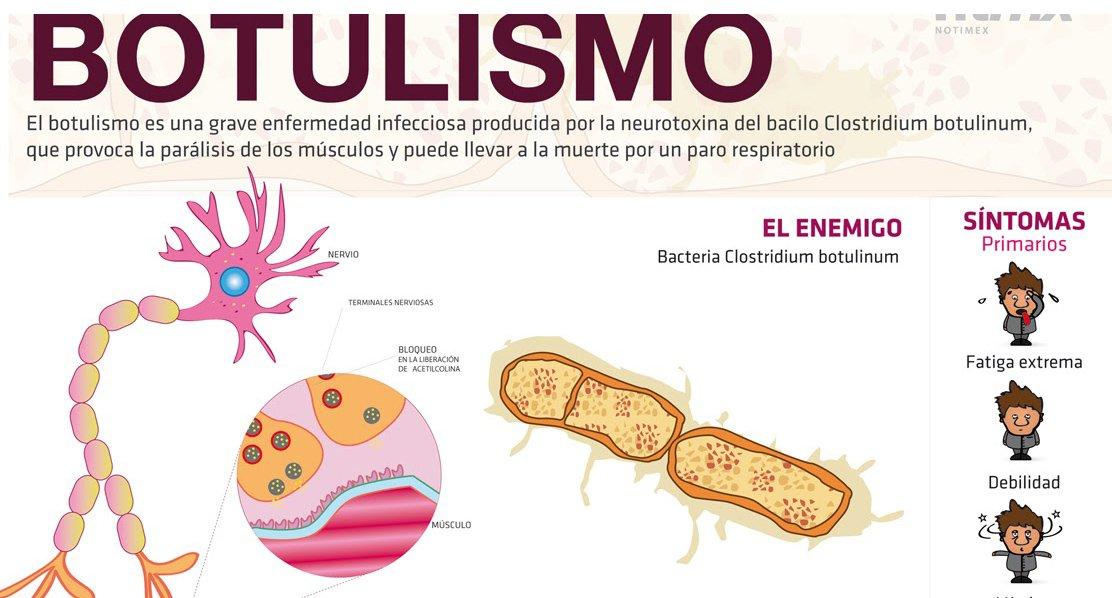 botulismo