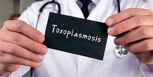 toxoplasmosis